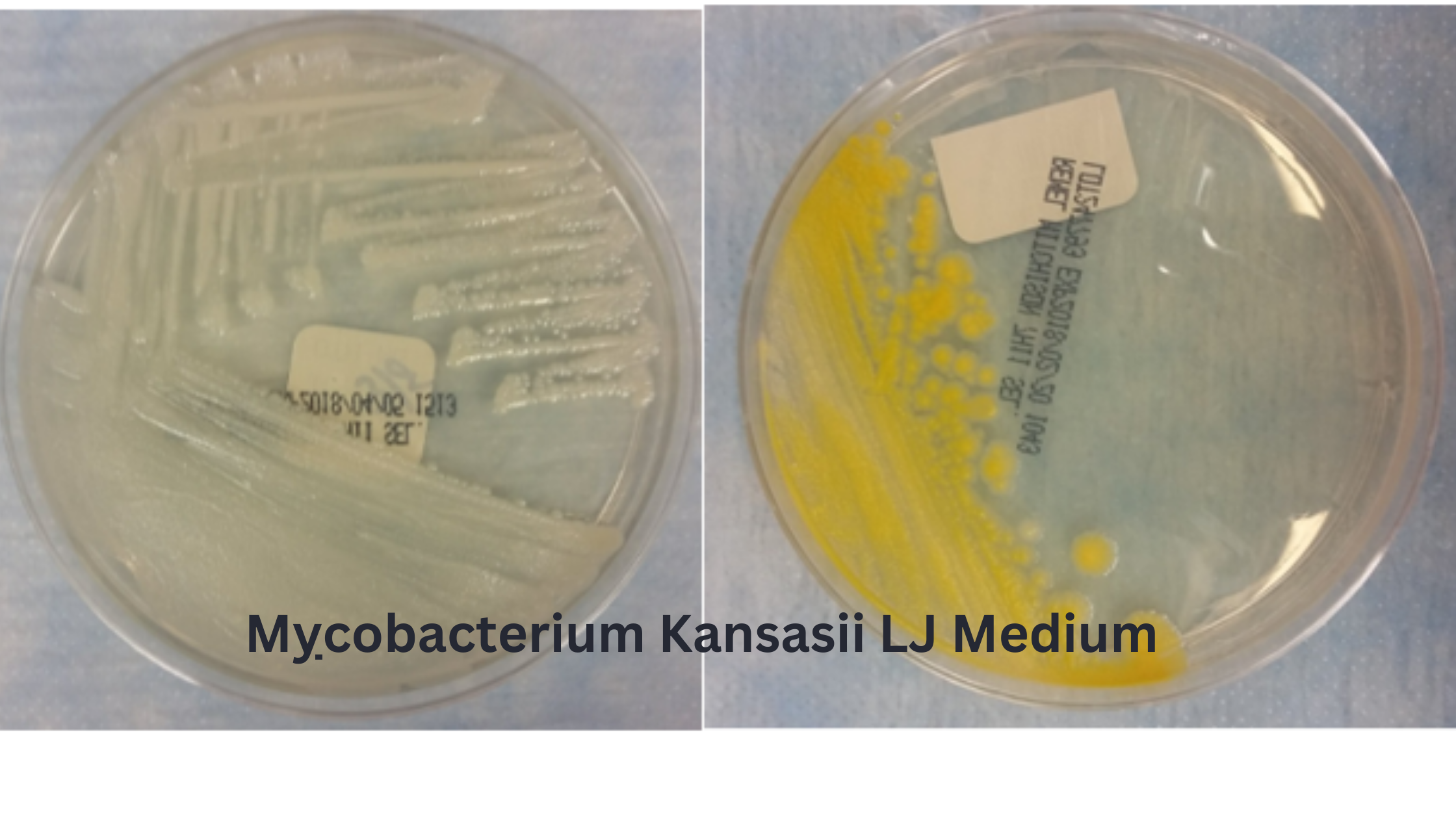 Mycobacterium Kansasii LJ Medium